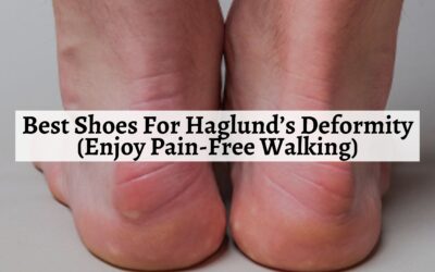 Best Shoes For Haglund’s Deformity